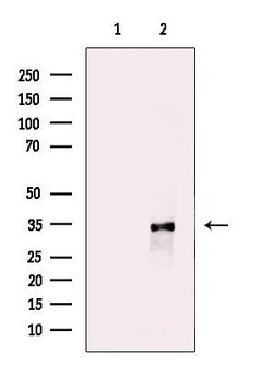 Invitrogen STARD10 Polyclonal Antibody 100 μL; Unconjugated:Antibodies,