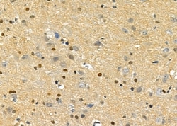 Invitrogen DUSP10 Polyclonal Antibody 100 &mu;L; Unconjugated:Antibodies,