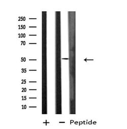 Invitrogen DUSP10 Polyclonal Antibody 100 &mu;L; Unconjugated:Antibodies,