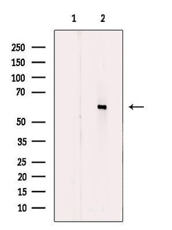 Invitrogen CYP11B1/CYP11B2 Polyclonal Antibody 100 &mu;L; Unconjugated:Antibodies,