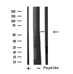 Invitrogen CYP11B1/CYP11B2 Polyclonal Antibody 100 &mu;L; Unconjugated:Antibodies,