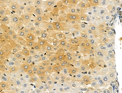 Invitrogen CYP11A1 Polyclonal Antibody 100 &mu;L; Unconjugated:Antibodies,