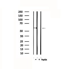 Invitrogen CYP11A1 Polyclonal Antibody 100 &mu;L; Unconjugated:Antibodies,