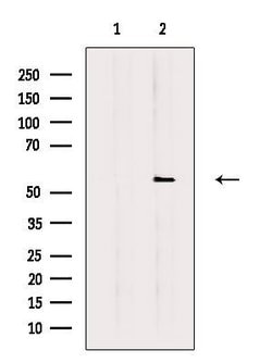Invitrogen FGFR5 Polyclonal Antibody 100 μL; Unconjugated:Antibodies,