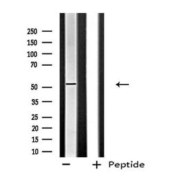 Invitrogen FGFR5 Polyclonal Antibody 100 μL; Unconjugated:Antibodies,