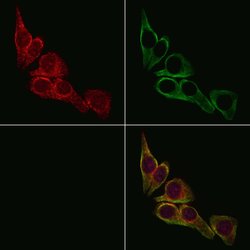 Invitrogen IL13RA2 Polyclonal Antibody 100 &mu;L; Unconjugated:Antibodies,