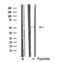 Invitrogen IL13RA2 Polyclonal Antibody 100 &mu;L; Unconjugated:Antibodies,