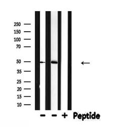 Invitrogen IL13RA2 Polyclonal Antibody 100 &mu;L; Unconjugated:Antibodies,