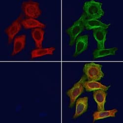 Invitrogen IL18BP Polyclonal Antibody 100 &mu;L; Unconjugated:Antibodies,