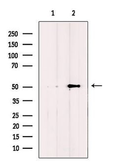 Invitrogen IFIT5 Polyclonal Antibody 100 &mu;L; Unconjugated:Antibodies,