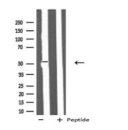 Invitrogen IFIT5 Polyclonal Antibody 100 &mu;L; Unconjugated:Antibodies,