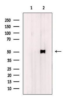 Invitrogen Cytokeratin 37/38 Polyclonal Antibody 100 &mu;L; Unconjugated:Antibodies,
