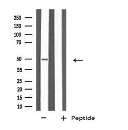 Invitrogen Cytokeratin 37/38 Polyclonal Antibody 100 &mu;L; Unconjugated:Antibodies,