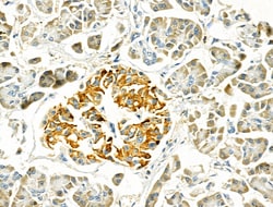 Invitrogen MYL3 Polyclonal Antibody 100 μL; Unconjugated:Antibodies,