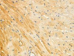 Invitrogen MYL3 Polyclonal Antibody 100 μL; Unconjugated:Antibodies,