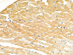 Invitrogen MYL3 Polyclonal Antibody 100 μL; Unconjugated:Antibodies,