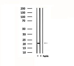 Invitrogen MYL3 Polyclonal Antibody 100 μL; Unconjugated:Antibodies,