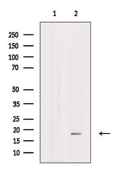 Invitrogen MYL6 Polyclonal Antibody 100 &mu;L; Unconjugated:Antibodies,