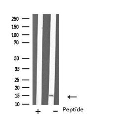 Invitrogen MYL6 Polyclonal Antibody 100 &mu;L; Unconjugated:Antibodies,