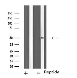 Invitrogen TUBA3C/TUBA3E Polyclonal Antibody 100 μL; Unconjugated:Antibodies,