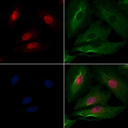 Invitrogen CHFR Polyclonal Antibody 100 &mu;L; Unconjugated:Antibodies,