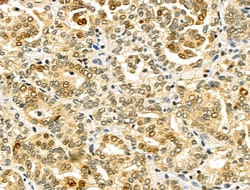 Invitrogen CHFR Polyclonal Antibody 100 &mu;L; Unconjugated:Antibodies,
