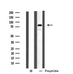 Invitrogen CHFR Polyclonal Antibody 100 &mu;L; Unconjugated:Antibodies,