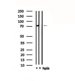 Invitrogen CHFR Polyclonal Antibody 100 &mu;L; Unconjugated:Antibodies,