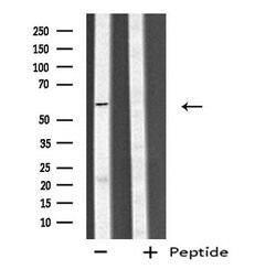 Invitrogen CYP4V2 Polyclonal Antibody 100 &mu;L; Unconjugated:Antibodies,