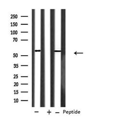 Invitrogen CYP2A6 Polyclonal Antibody 100 &mu;L; Unconjugated:Antibodies,