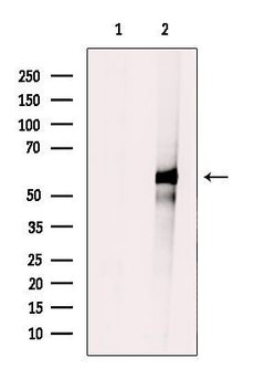 CYP2A7 Polyclonal Antibody, Invitrogen 100 &mu;L | Buy Online | Thermo Scientific | Fisher Scientific