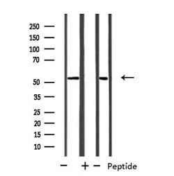 Invitrogen CYP39A1 Polyclonal Antibody 100 &mu;L; Unconjugated:Antibodies,