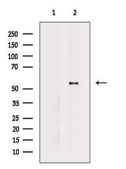 Invitrogen CYP39A1 Polyclonal Antibody 100 &mu;L; Unconjugated:Antibodies,