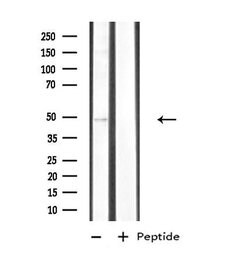 Invitrogen CK1 delta Polyclonal Antibody 100 μL; Unconjugated:Antibodies,