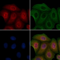 Invitrogen CK1 delta Polyclonal Antibody 100 μL; Unconjugated:Antibodies,