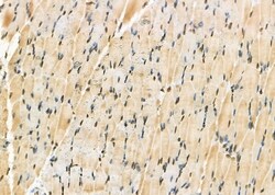 Invitrogen CK1 delta Polyclonal Antibody 100 μL; Unconjugated:Antibodies,