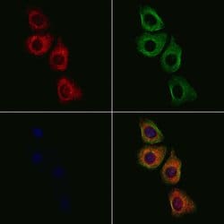 Invitrogen MATK Polyclonal Antibody 100 &mu;L; Unconjugated:Antibodies,
