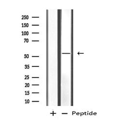 Invitrogen MATK Polyclonal Antibody 100 &mu;L; Unconjugated:Antibodies,