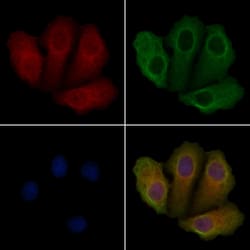Invitrogen STK33 Polyclonal Antibody 100 &mu;L | Buy Online | Invitrogen&trade; | Fisher Scientific
