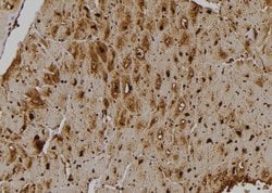Invitrogen STK33 Polyclonal Antibody 100 &mu;L | Buy Online | Invitrogen&trade; | Fisher Scientific