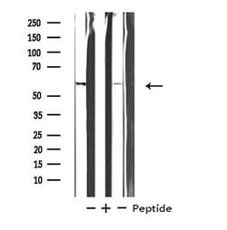Invitrogen STK33 Polyclonal Antibody 100 &mu;L | Buy Online | Invitrogen&trade; | Fisher Scientific
