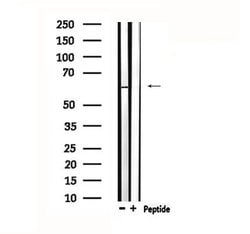 Invitrogen TESK2 Polyclonal Antibody 100 &mu;L | Buy Online | Invitrogen&trade; | Fisher Scientific