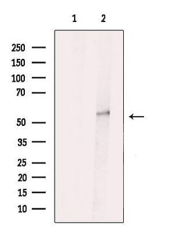 Invitrogen VRK3 Polyclonal Antibody 100 &mu;L; Unconjugated:Antibodies,