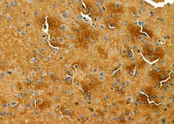 Invitrogen LRP8 Polyclonal Antibody 100 &mu;L; Unconjugated:Antibodies,