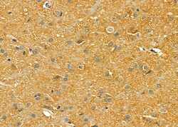Invitrogen LRP8 Polyclonal Antibody 100 &mu;L; Unconjugated:Antibodies,