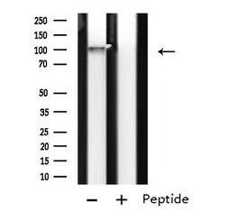 Invitrogen LRP8 Polyclonal Antibody 100 &mu;L; Unconjugated:Antibodies,