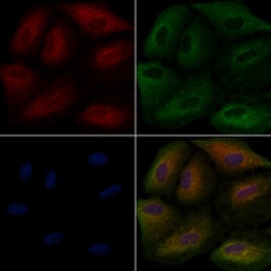 Invitrogen CD205 Polyclonal Antibody 100 &mu;L; Unconjugated:Antibodies,