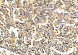 Invitrogen CD205 Polyclonal Antibody 100 &mu;L; Unconjugated:Antibodies,