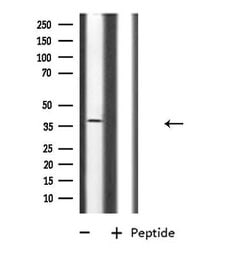 Invitrogen CD300g Polyclonal Antibody 100 μL; Unconjugated:Antibodies,