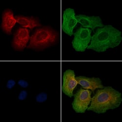 Invitrogen IL4I1 Polyclonal Antibody 100 μL; Unconjugated:Antibodies,